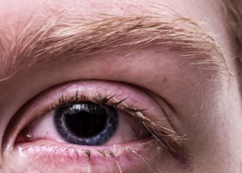 Uzmanı uyardı: Gözlerinizi klimadan koruyun