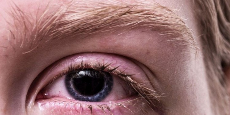 Uzmanı uyardı: Gözlerinizi klimadan koruyun