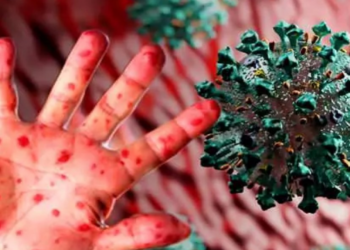 Adım Adım Maymun Çiçeği Virüsü Haritası: Hangi Ülkede Kaç Vaka Ortaya Çıktı