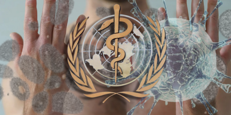 DSÖ'den Yeni Açıklama: Maymun Çiçeği Pandemiye Dönüşür Mü?