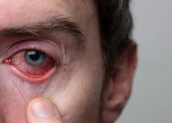 Gözünüzde Bu Belirtiler Varsa Dikkat! Gözünüzü Kaybedebilirsiniz