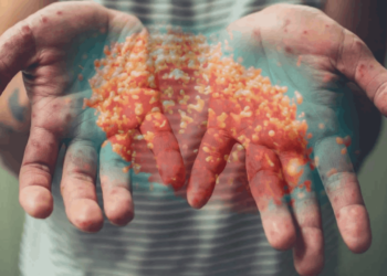 İstanbul'da Maymun Çiçeği Vakası Görüldü mü?