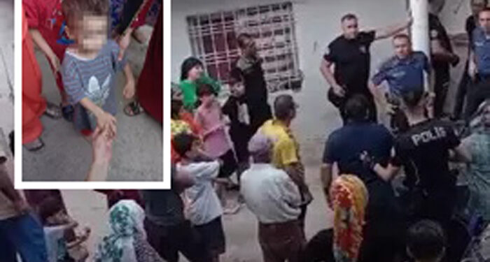 Mardin’de 3 yaşındaki çocuğa işkence: Anne ve baba tutuklandı