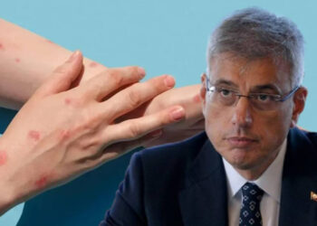 Maymun Çiçeği Türkiye'de Görüldü Mü? Sağlık Bakanı Memişoğlu'ndan Açıklama