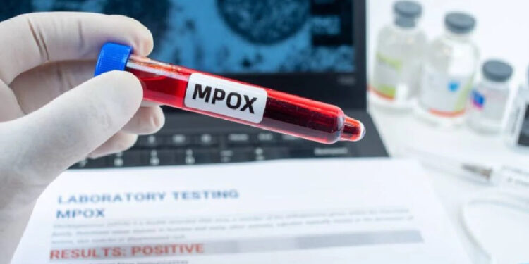 Maymun Çiçeği Virüsü Bir Ülkeye Daha Sıçradı