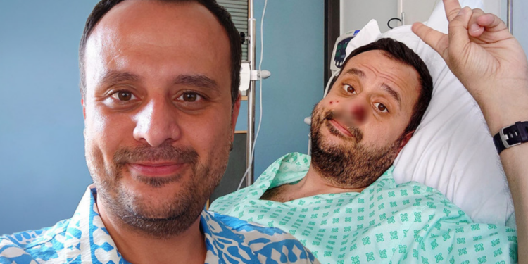 Maymun Çiçeğine Yakalanan Türk Vatandaşı Yaşadıklarını Anlattı: "İlk Fark Ettiğimde..."