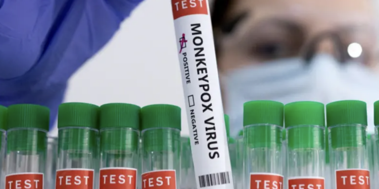 Maymun çiçeği virüsü Avrupa’ya sıçradı, Afrika dışında ilk vaka İsveç’te görüldü