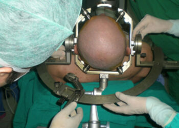 Skandal, İsimsiz İhbarla Ortaya Çıktı: Beyin Cerrahı, 13 Yaşındaki Kızına Hastanın Kafasında Delik Açtırdı!