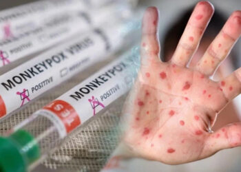 Türkiye'de İlk Ne Zaman Ortaya Çıktı? İşte Maymun Çiçeği Hakkında Bilinmeyenler