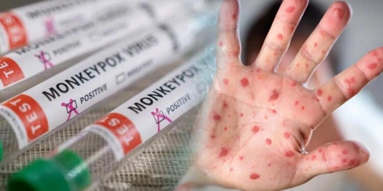 Türkiye'de İlk Ne Zaman Ortaya Çıktı? İşte Maymun Çiçeği Hakkında Bilinmeyenler