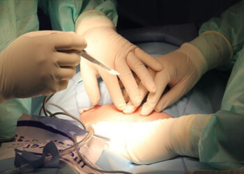 Hastanede Skandal Hata! Ameliyatta Yanlış Organı Alınan Hasta Öldü