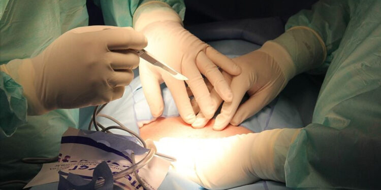 Hastanede Skandal Hata! Ameliyatta Yanlış Organı Alınan Hasta Öldü