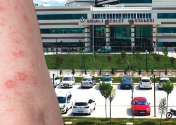 Konya'daki Yoğun Bakımda Bu Kez Uyuz Skandalı