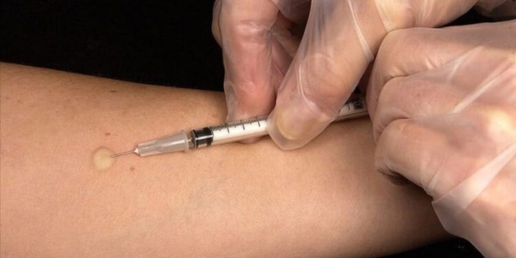 Sağlıkçılar Hepatit B, tetanoz ve kızamık aşılarını bulamıyor