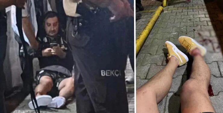 Serhat Akın’a silahlı saldırı: Beş kişi hakkında yakalama kararı