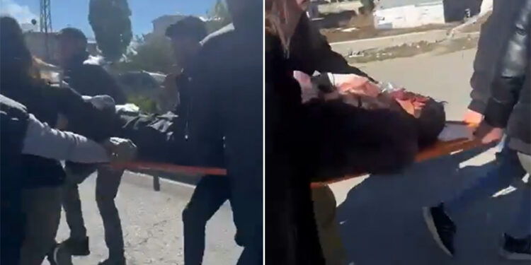 Ağrı’da ambulans skandalı: Hastaneye 350 metre mesafede kaza yapan vatandaş kan kaybından öldü