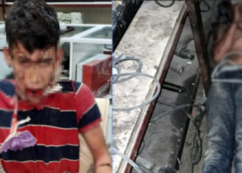 Patrondan İşçiye Günlerce İşkence! Darp Etti, Böcek Yedirdi, Dişlerini Kırdı...