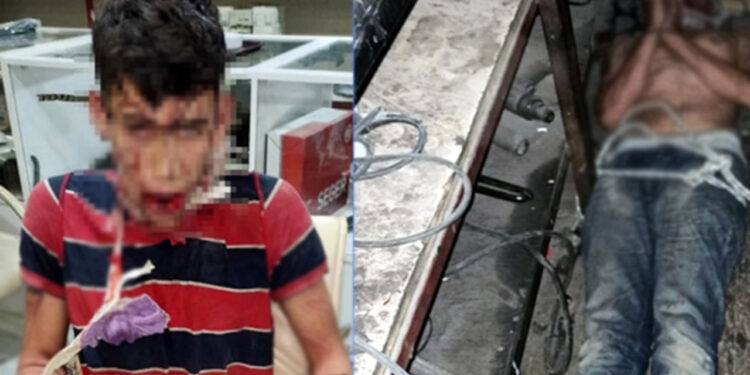 Patrondan İşçiye Günlerce İşkence! Darp Etti, Böcek Yedirdi, Dişlerini Kırdı...