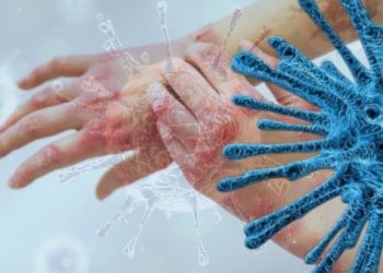 Türkiye Alarmda, Vakalar Her Gün Artıyor: Kaşıntıyı Hafife Almayın