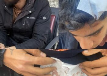 Altındağ’da bekçi şiddeti: Darp edilen gençler gözaltında