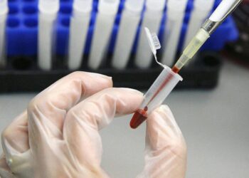 AIDS’ten ölen çocuk için ‘aile içi cinsel istismar’ şüphesi: “Baba HIV pozitif, anne değil”