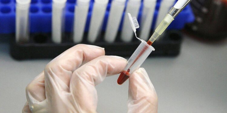 AIDS’ten ölen çocuk için ‘aile içi cinsel istismar’ şüphesi: “Baba HIV pozitif, anne değil”