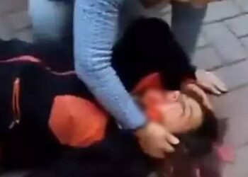 Ankara'da yürüyüşe çıkan profesör, köpeklerin saldırısında yaralandı