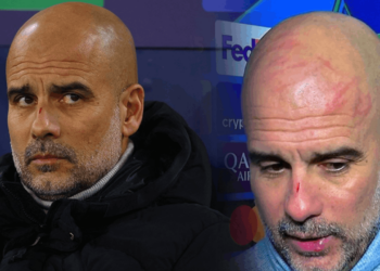 Maç Sonu Dayak Yemiş Gibi Röportaja Geldi: Guardiola'nın Yüzündeki Çiziklerin Sebebi Belli Oldu