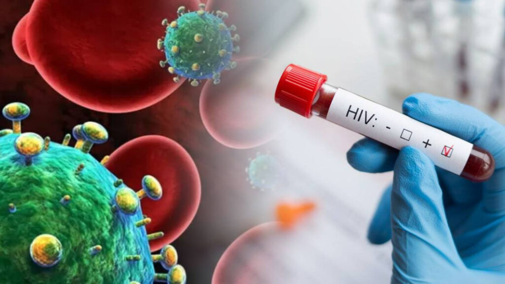 Türkiye’de HIV/AIDS Alarm Veriyor... Profesör Korkutan Rakamları Verdi! En Çok Onlara Bulaşıyor...