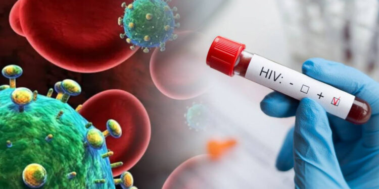 Türkiye’de HIV/AIDS Alarm Veriyor... Profesör Korkutan Rakamları Verdi! En Çok Onlara Bulaşıyor...