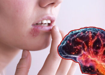 Uzmanlar Açıkladı, Öyle Bir Hastalığa Yol Açıyor Ki...