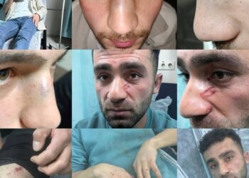 Colemêrg’te polis şiddeti: Darp raporu alan gençler gözaltında