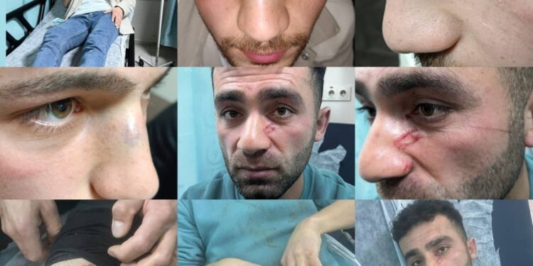 Colemêrg’te polis şiddeti: Darp raporu alan gençler gözaltında