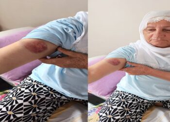 Şiddet uygulayan polisler hakkında suç duyurusu