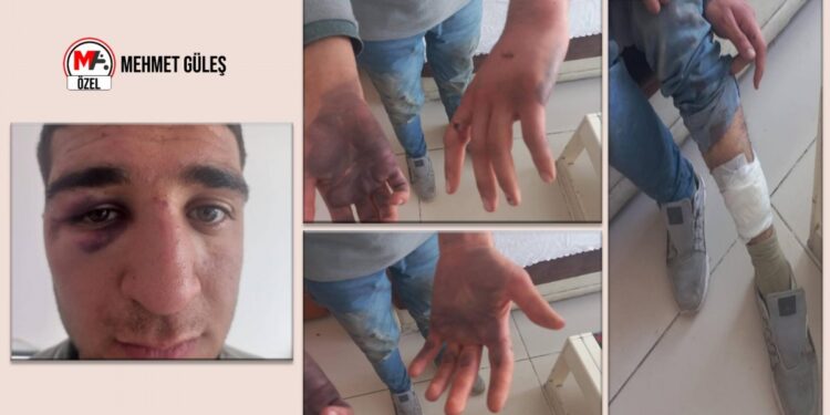 Gözaltında asker işkencesine ‘düşerken oldu’ kılıfı