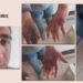 Gözaltında asker işkencesine ‘düşerken oldu’ kılıfı