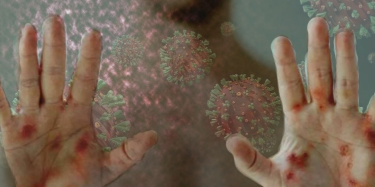 2 Çocukta Tespit Edildi, Okula Ara Verildi