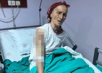 65 yaşındaki kadına 7 köpek saldırdı; vücuduna 50 dikiş atıldı