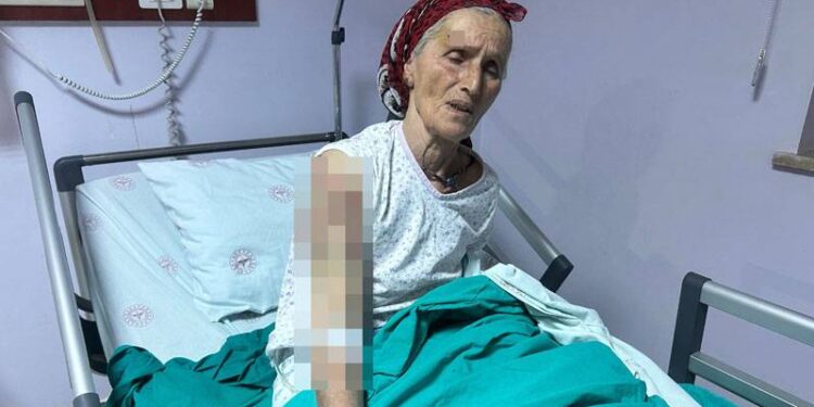 65 yaşındaki kadına 7 köpek saldırdı; vücuduna 50 dikiş atıldı