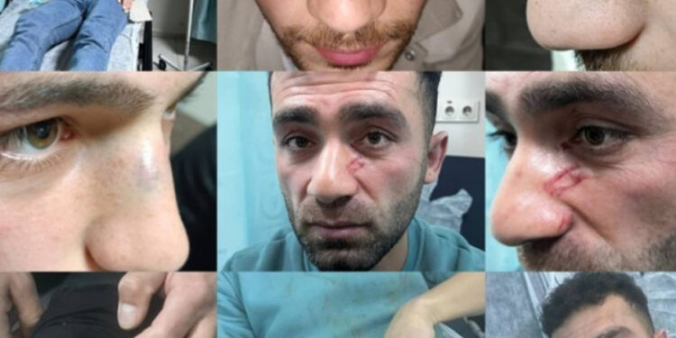 Hakkari’de sivil polis aracını sollayan 4 gence çıplak arama işkencesi ve darp
