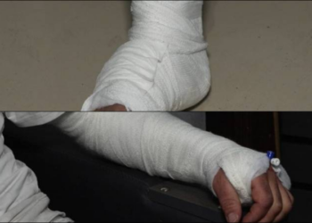 İnsanın başına gelmeyecek şey benim başıma geldi!