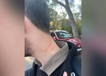 Medipol Üniversitesi'nde şiddet iddiası; dekan yardımcısı bir öğrenciyi darbetti