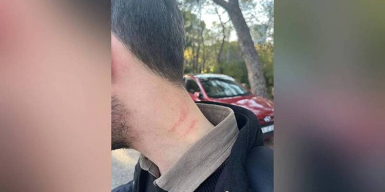 Medipol Üniversitesi'nde şiddet iddiası; dekan yardımcısı bir öğrenciyi darbetti