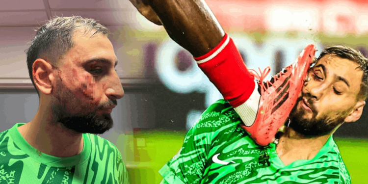 PSG'nin Yıldız Kalecisi Donnarumma'nın Yüzü Parçalandı! Kart Bile Çıkmadı