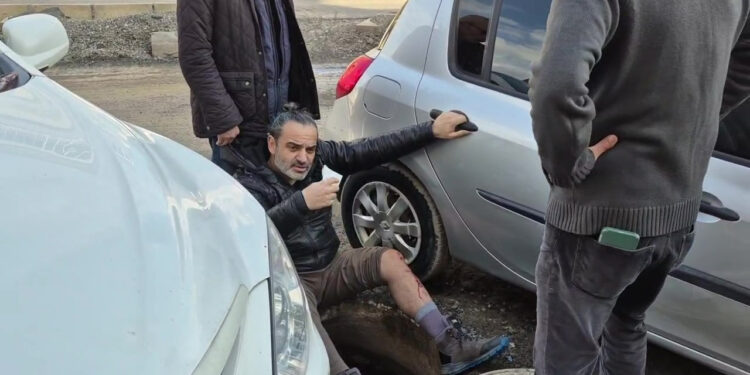 Rögar Kapağına Basmasıyla Kendini Çukurda Buldu