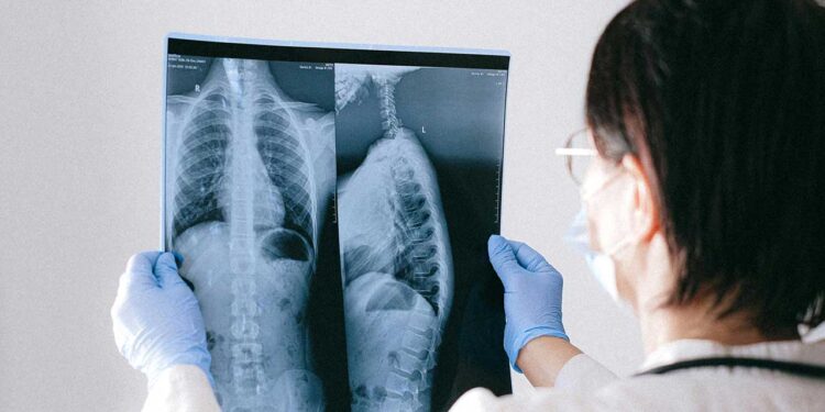 'Solunum yolu enfeksiyonları nedeniyle yoğun bakımlarda artış var'