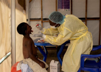 Kongo'da M Çiçeği salgını: Bir haftada 20 kişi öldü