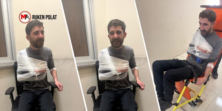 Kayyım protestosunda işkence: Polis, omuz ve parmaklarını kırdı