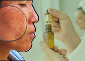 İkisi Birleşirse Cildi Yakıyor, Herkesin Uyguladığı Bakım Rutini Yanlış Çıktı