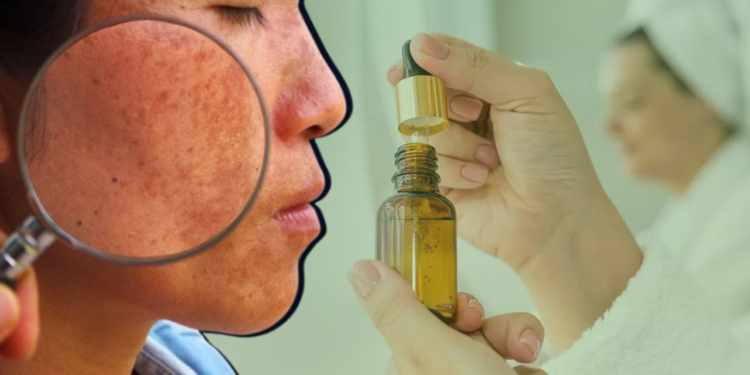 İkisi Birleşirse Cildi Yakıyor, Herkesin Uyguladığı Bakım Rutini Yanlış Çıktı